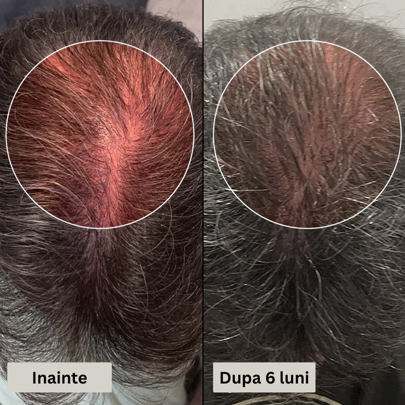 2-in-1 Foundation with Built-In Brush